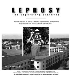 Leprosy The Separating Sickness exhibit